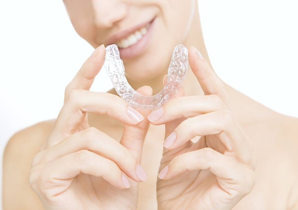 invisalign aligners newcastle wa