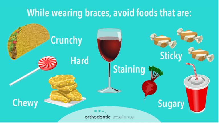 foods-to-eat-avoid-with-braces-so-treatment-stays-on-trackorthodontic