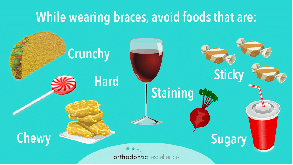 What Foods Can You Eat With New Braces 