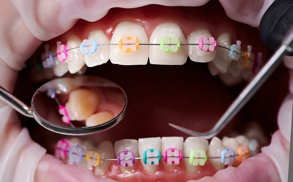 Dental Implants Periodontist In Garland
