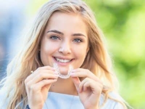 Invisalign Journey