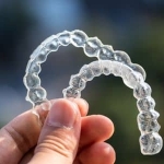 Invisalign Journey