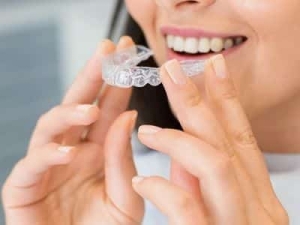 smile with Invisalign