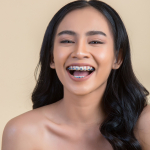 Braces 101: Your Ultimate Guide to Orthodontic Success