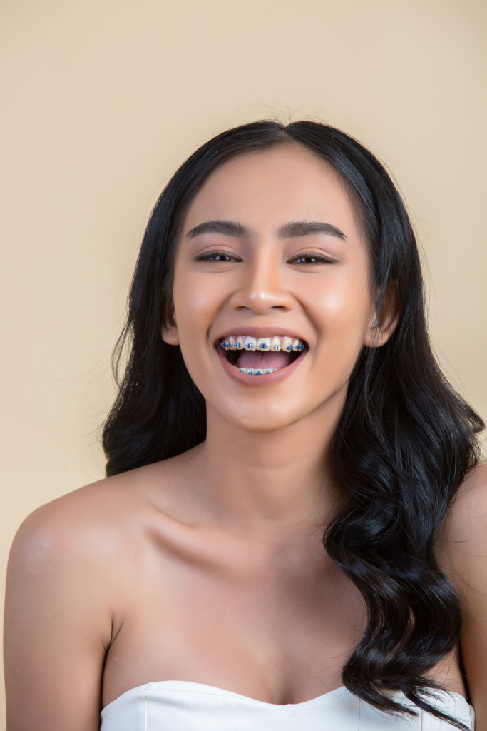 Braces 101: Your Ultimate Guide to Orthodontic Success