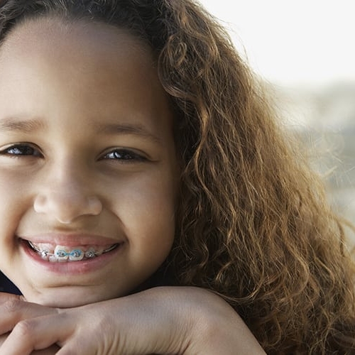 oe-smiles-traditional-braces