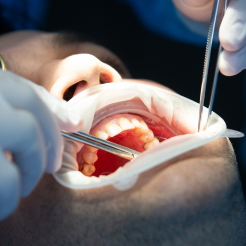 orthodontics-surgery