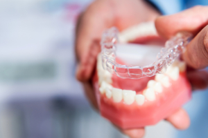 benefits of Invisalign