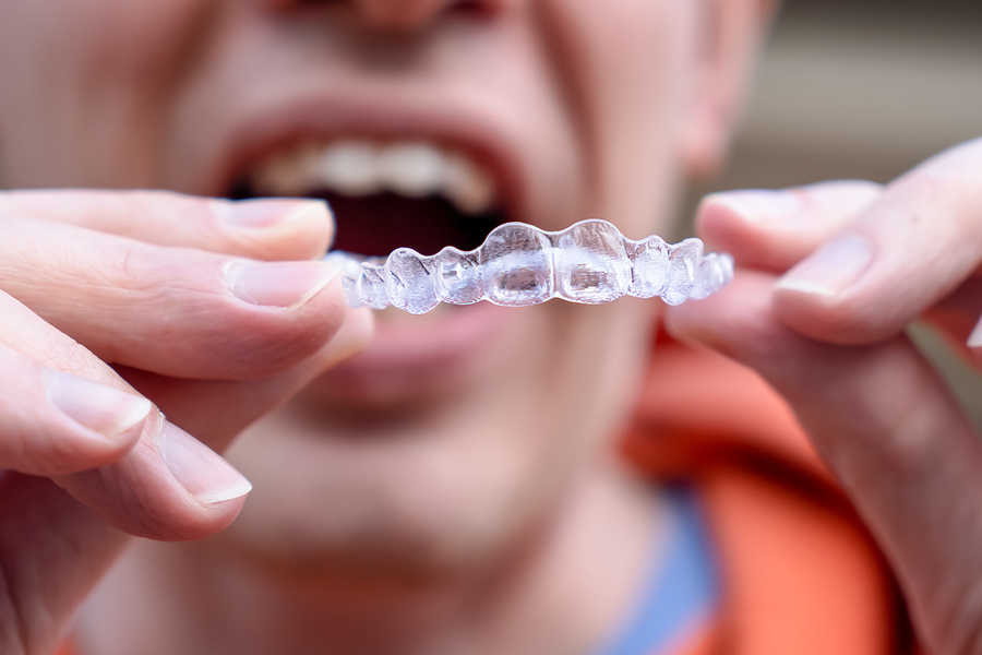 Future of Orthodontics: Exploring Innovations in Dental Care