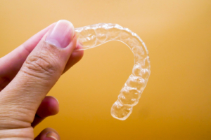 How Invisalign Improves Oral Health: Unlock Clear Aligner Benefits