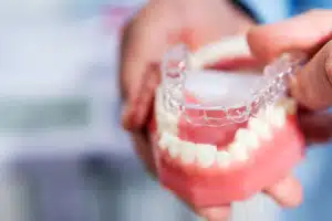 Wear Invisalign Daily: Proven Reasons to Stick to 22 Hours
