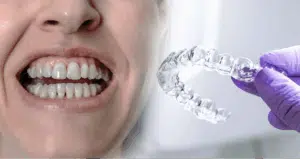 Invisalign Attachments: Key to More Precise Tooth Movement