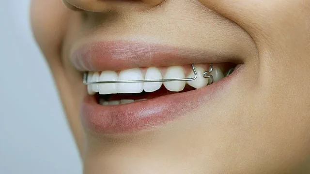 Gum Swelling